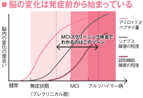 MCI判定ゾーン