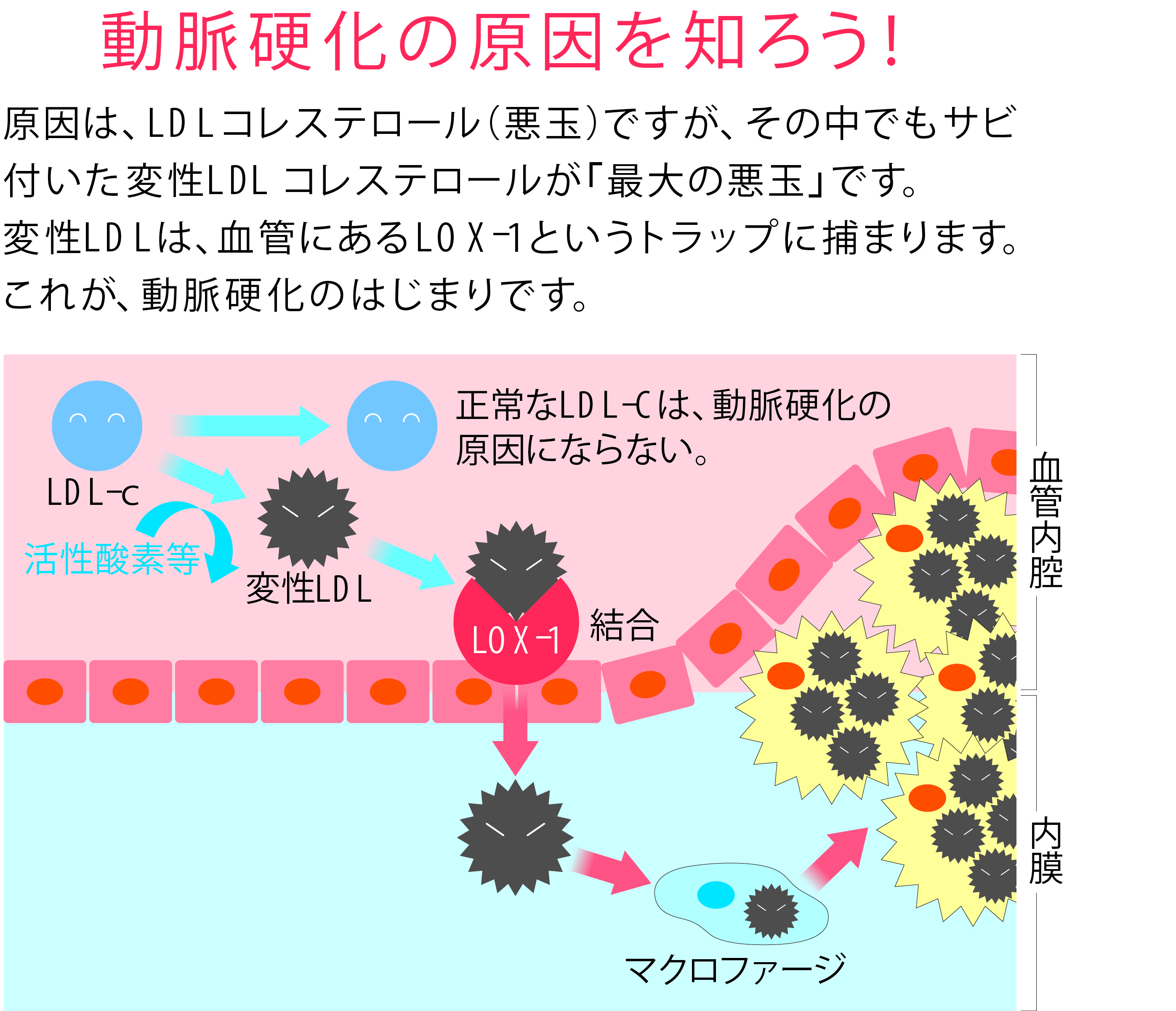 動脈硬化の原因を知ろう